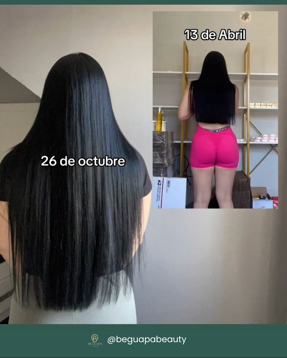 Gotero Anticaida y Crecimiento